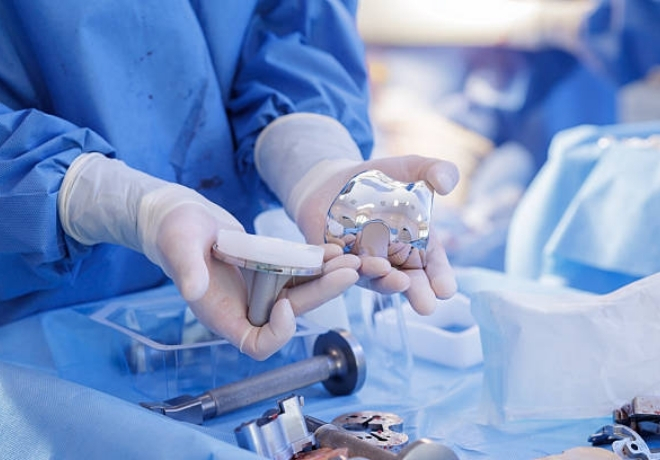 Who Should Consult a Knee Replacement Surgeon