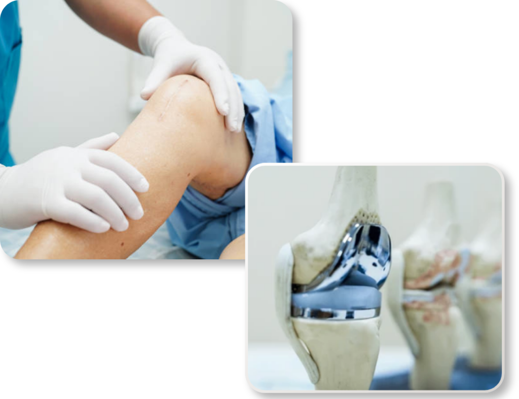 Knee Replacement Surgeon in Mumbai